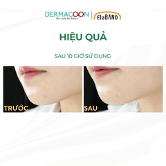 Miếng dán mụn che khuyết điểm và giảm mụn Elaband Hydro Dot Tea Tree (Hộp 23 miếng)