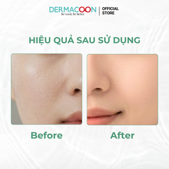 PAXMOLY Centella Cica 5X Repair Cream 100g Kem dưỡng Rau Má giúp cấp ẩm sâu, làm dịu và phục hồi cho da 100g