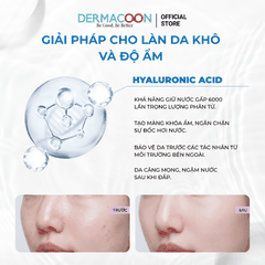 Mặt nạ dưỡng ẩm giúp làm dịu da và cải thiện da khô ráp PAX MOLY Real Hyaluronic Acid Mask Pack (5 Miếng)