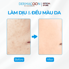 Tinh chất giúp dưỡng ẩm chuyên sâu và làm đều màu da PAX MOLY Niacinamide 5% + Hyaluronic Acid 5% AC Serum 50ml