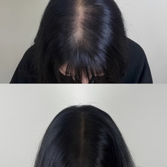 Serum Tóc The Ordinary Multi-Peptide For Hair Density 30ml – Hỗ Trợ Tóc Trông Dày Và Khỏe Hơn