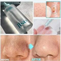 Tinh Chất Ủ Mụn Đầu Đen Ilso Super Melting Serum Softener 150ml + 40 Miếng Bông Tẩy Trang