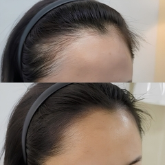 Tinh Chất Mọc Tóc L’Oréal Aminexil Advanced 30ml – Hỗ Trợ Giảm Rụng, Tăng Mật Độ Tóc