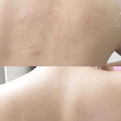 Sữa tắm Aderma Gel douche Hydra Protecteur 3in1 dưỡng ẩm, giảm mụn, 500ml