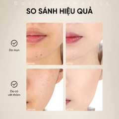 Cọ Che Khuyết Điểm AMORTALS 2 Đầu Chuyên Dụng