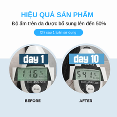 Mặt Nạ Ngủ Cấp Ẩm Sáng Da Ngừa Lão Hóa Skin1004 Madagascar Centella Hyalu-cica Sleeping Pack 100ml