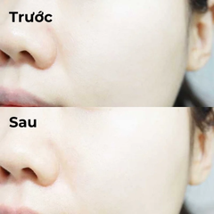 Tinh Chất Rau Má Lên Men Skin1004 Madagascar Centella Probio-Cica Intensive Ampoule