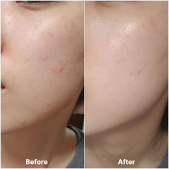Kem Chống Nắng Cho Da Nhạy Cảm Skin1004 Madagascar Centella Air-Fit Suncream Plus Spf50+ Pa++++