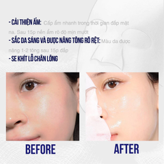 Mặt Nạ Dưỡng Da SurMedic