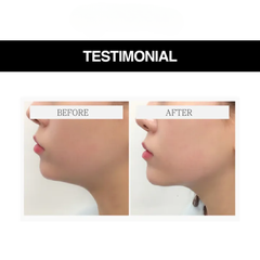 Mặt Nạ Hỗ Trợ Nâng Cơ Design Your Beauty Black Edition Premium Gold Collagen V – Line Patch Prettyskin