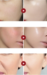 Enprani Retinoate X8 Pro Deep Wrinkle Repair Cushion