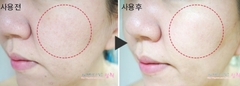 Sữa Dưỡng Chống Nhăn Enprani Retinoate X8 Pro