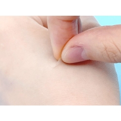 Miếng dán trị mụn Acnes 66 miếng