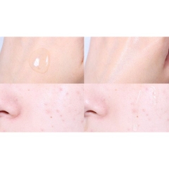Sữa dưỡng ẩm Acnes 200ml