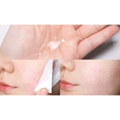 Sữa dưỡng ẩm Acnes 200ml