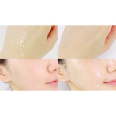 Sữa dưỡng ẩm Acnes 200ml