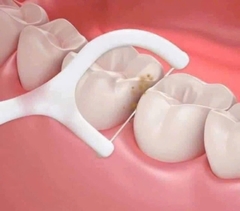 SET 3 TĂM CHỈ NHA KHOA - HỘP 50 CÁI
