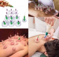 Bộ Giác Hơi 12 Món Không dùng Lửa Có Dây Nối
