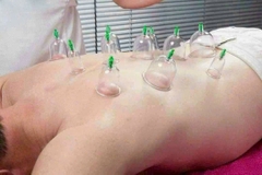 Bộ Giác Hơi 12 Món Không dùng Lửa Có Dây Nối