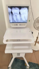 Xe đẩy máy quét nha khoa