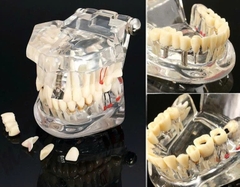 Hàm tư vấn nha khoa