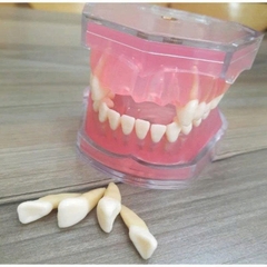 Mô hình răng