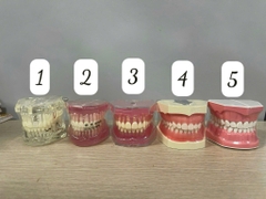 Hàm tư vấn nha khoa