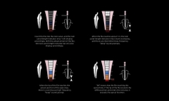 Máy định vị chóp Woodpex V