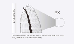 Máy định vị chóp Woodpex III