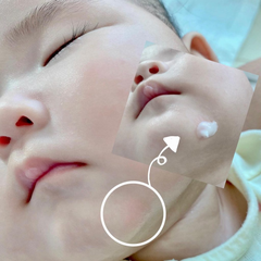 Kem Phục Hồi Chuyên Biệt Atono2 SOS Cream cho bé 20ml cho bé 0m+