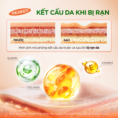 Bơ đậm đặc ngăn ngừa và hỗ trợ làm mờ rạn da cho mẹ bầu cuối thai kỳ và sau sinh Palmer's 125g