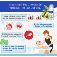 Dầu Gội giảm Cứt Trâu (Viêm Da Tiết Bã) Mustela Foam Shampoo For Newborns 150ml