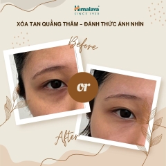 [MUA 1 TẶNG 1] Kem dưỡng giảm quầng thâm mắt Himalaya Under Eye Cream 15ML + 1 HŨ SRM NGHỆ 14 TUÝP