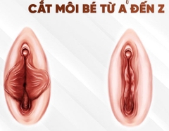 Thẩm mỹ môi bé