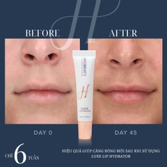 HYDRINITY LUXE LIP HYDRATOR: Khoa Học Gặp Gỡ Sang Trọng - "Filler Không Tiêm" Cho Đôi Môi Căng Mọng