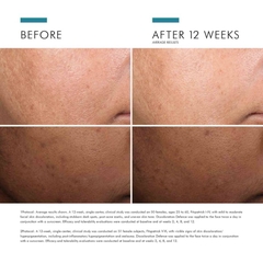 SKINCEUTICALS DISCOLORATION DEFENSE/ SERUM MỜ THÂM NÁM VÀ LÀM SÁNG ĐỀU MÀU DA