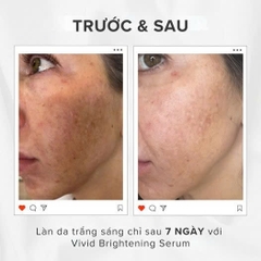 HYDRINITY VIVID BRIGHTENING SERUM: Tinh Chất Làm Sáng Da & Cấp Ẩm Vượt Trội Với Công Nghệ RPH™ Độc Quyền