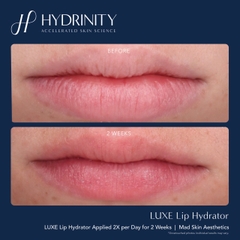 HYDRINITY LUXE LIP HYDRATOR: Khoa Học Gặp Gỡ Sang Trọng - "Filler Không Tiêm" Cho Đôi Môi Căng Mọng