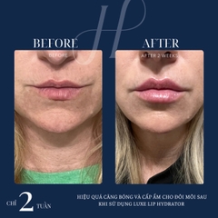 HYDRINITY LUXE LIP HYDRATOR: Khoa Học Gặp Gỡ Sang Trọng - "Filler Không Tiêm" Cho Đôi Môi Căng Mọng