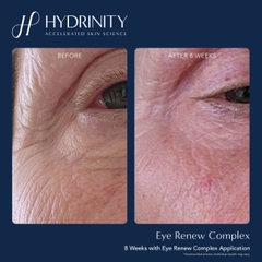 HYDRINITY Eye Renew Complex: Tinh Chất Tái Sinh Vùng Mắt - Giải Pháp Xóa Nhăn, Mờ Thâm Đa Tác Động