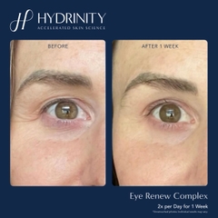 HYDRINITY Eye Renew Complex: Tinh Chất Tái Sinh Vùng Mắt - Giải Pháp Xóa Nhăn, Mờ Thâm Đa Tác Động