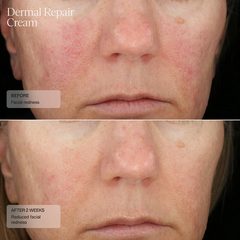 SANTÉ DERMAL REPAIR CREAM/ KEM DƯỠNG PHỤC HỒI VÀ NUÔI DƯỠNG LÀN DA