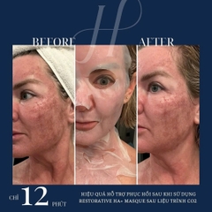 Hydrinity Restorative HA+ Masque: Mặt Nạ Phục Hồi Cao Cấp - "Lớp Da Thứ Hai" Tái Sinh Làn Da Tổn Thương