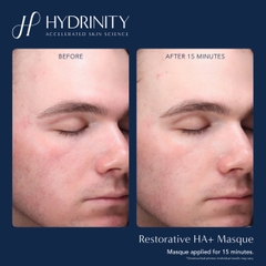 Hydrinity Restorative HA+ Masque: Mặt Nạ Phục Hồi Cao Cấp - "Lớp Da Thứ Hai" Tái Sinh Làn Da Tổn Thương