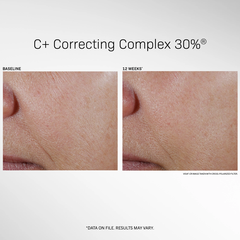 REVISION SKINCARE C+ Correcting Complex 30%- SERUM LÀM SÁNG, GIẢM NÁM, TRẺ HOÁ DA
