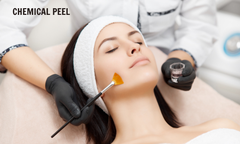 Peel xử lí mụn viêm, mụn bọc, nang