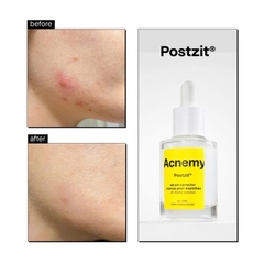 ACNEMY Postzit Serum 30ml