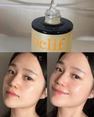 Serum dưỡng trắng trị nám belif