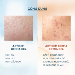 Gel giảm mụn Actidem Derma Gel 18/40gr