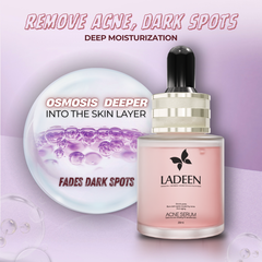 Acne Serum Ladeen 20ml